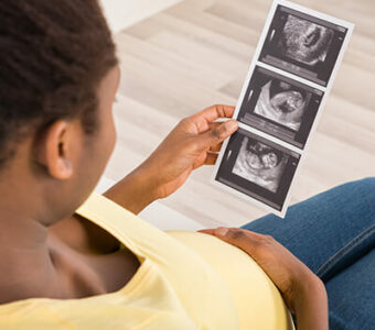 Person holding ultrasound and also holding their pregnant stomach